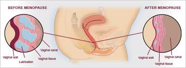 Multiple partners thinning of vaginal wall Asian multiple fucking orgasim